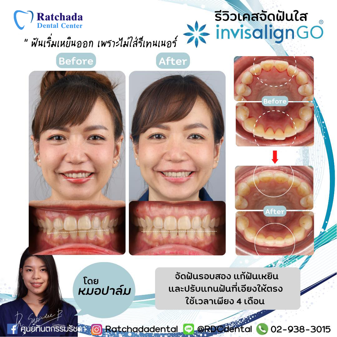 ศูนย์ทันตกรรมรัชดา